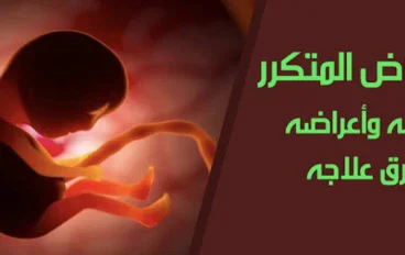 الإجهاض المتكرر: التعريف والأسباب والأعراض وطرق العلاج الطبي