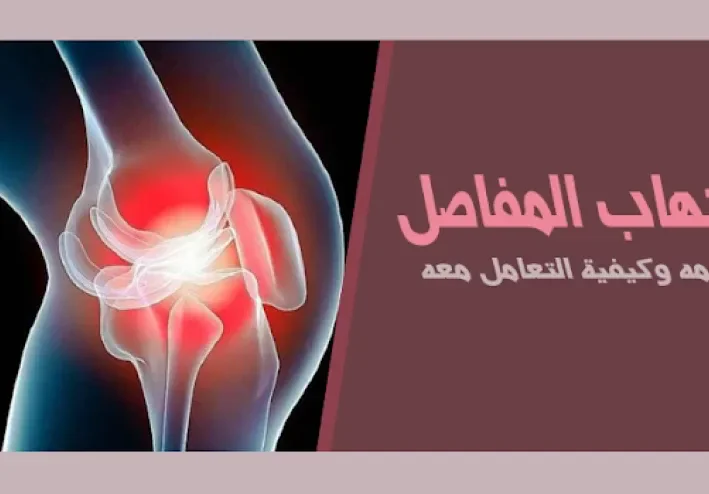 التهاب المفاصل: التعريف والأعراض والعلاج