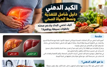 الكبد الدهني: الأعراض والأسباب والأطعمة المناسبة وأفضل طرق التعامل معه