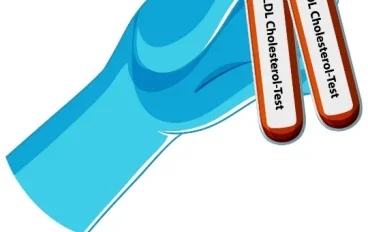 أهم الأسئلة حول الكوليسترول الضار: ما الذي يحدث داخل الشرايين دون أن نشعر؟