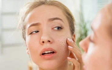How to treat cracked face, elbows and heels