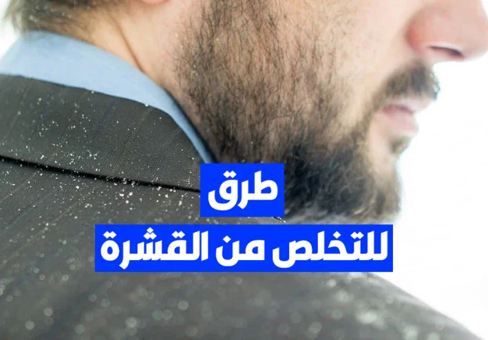4 طرق للتخلص من قشرة الشعر للرجال نهائيا