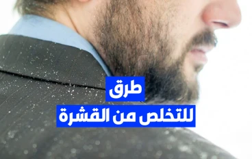 4 طرق للتخلص من قشرة الشعر للرجال نهائيا